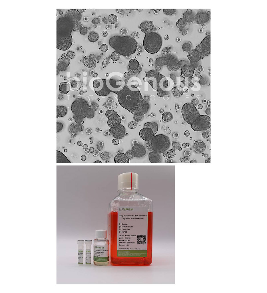 Lung Squamous Cell Carcinoma Organoid Kit肺鳞癌