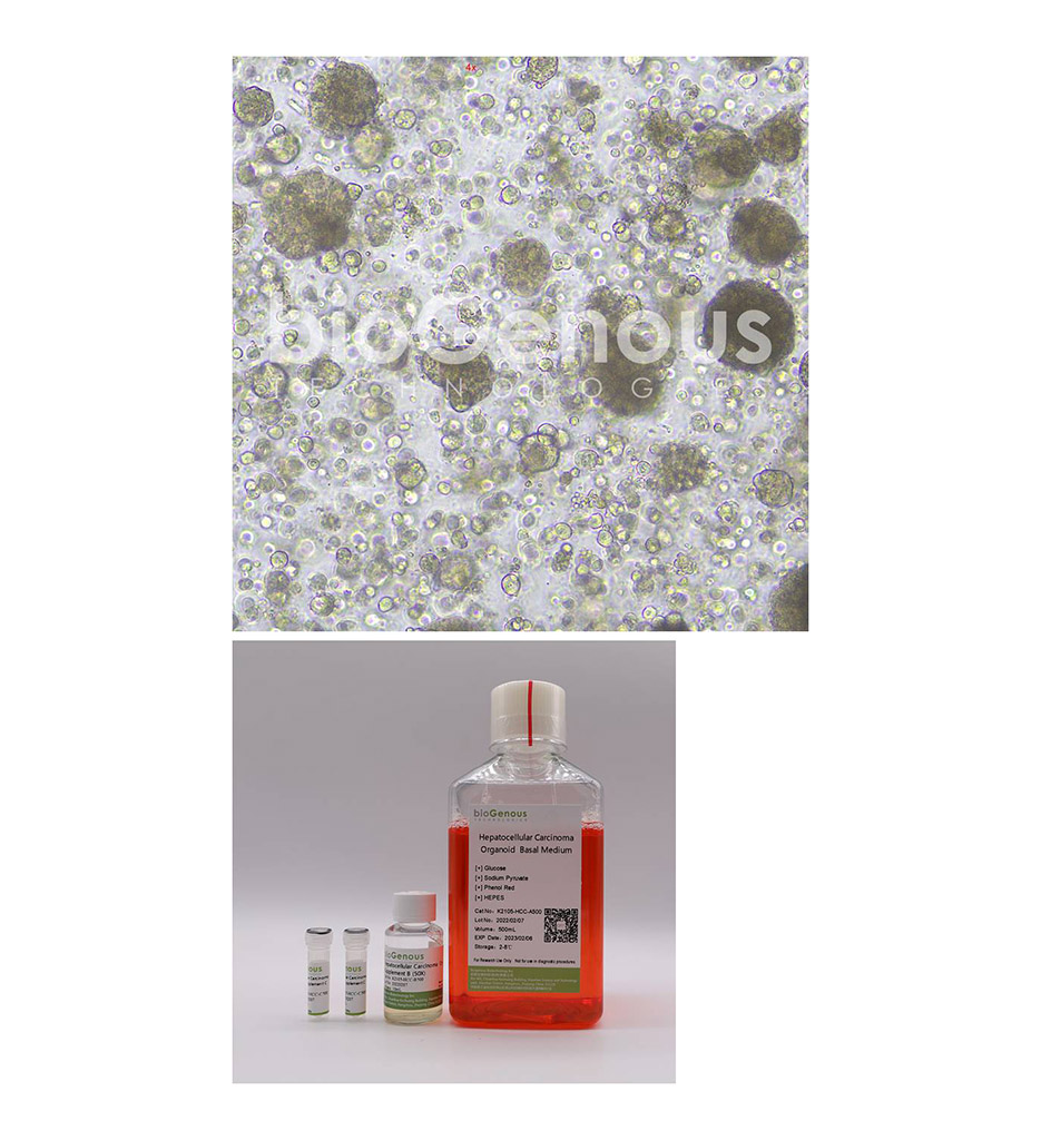 Hepatocellular Carcinoma Organoid Kit肝实质细胞癌