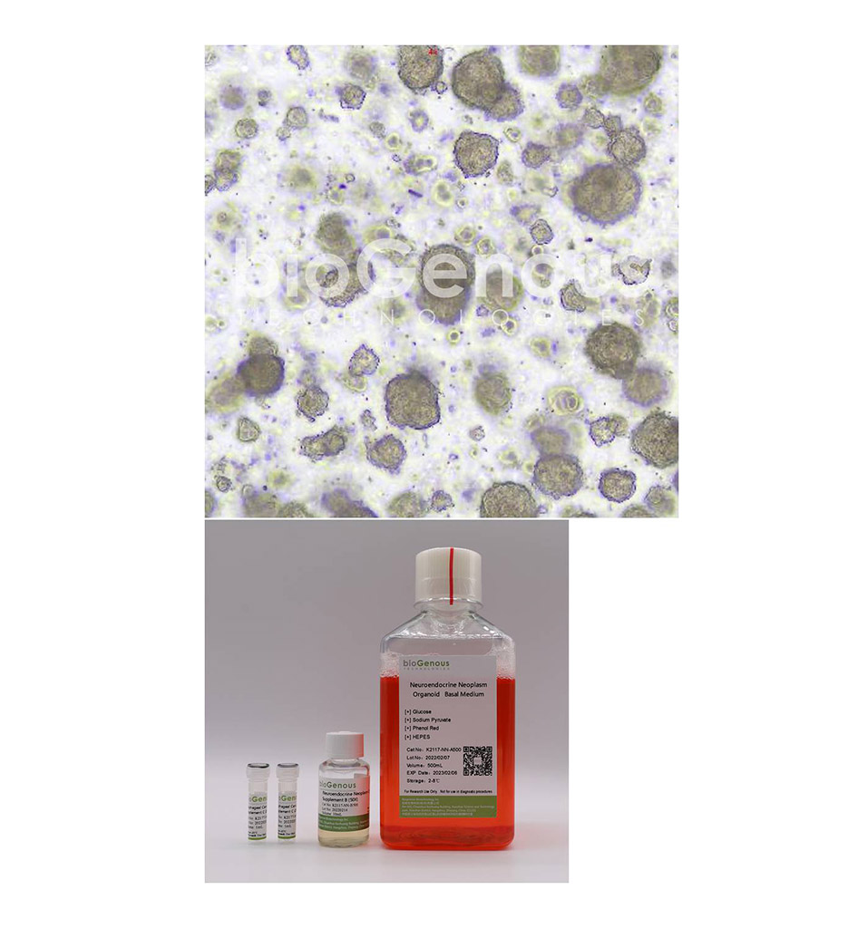 Neuroendocrine Neoplasm Organoid Kit神经内分泌细胞癌