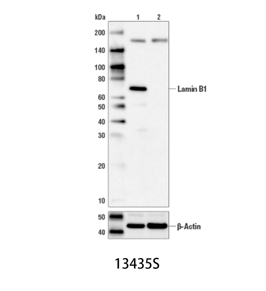 Lamin B1 (D9V6H) Rabbit mAb