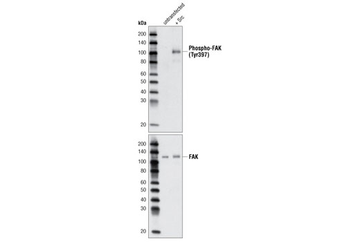 Phospho-FAK (Tyr397) Antibody