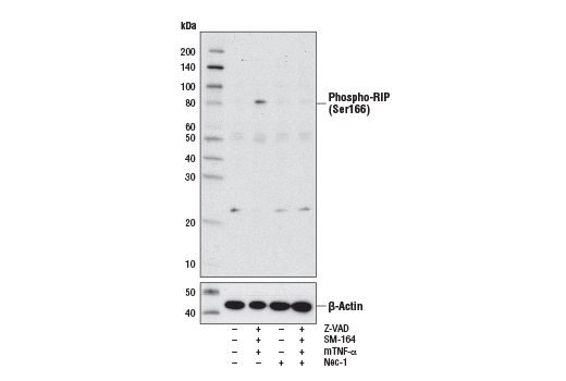 Phospho-RIP (Ser166) Antibody (Rodent Specific)