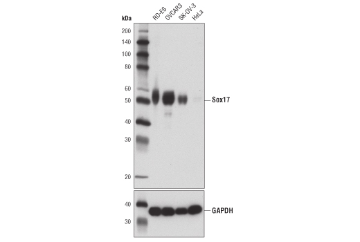 Sox17 (D1T8M) Rabbit mAb