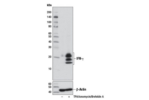 IFN-γ (D3H2) XP Rabbit mAb