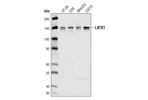 LATS1 (C66B5) Rabbit mAb
