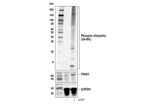 Phospho-Ubiquitin (Ser65) (E2J6T) Rabbit mAb