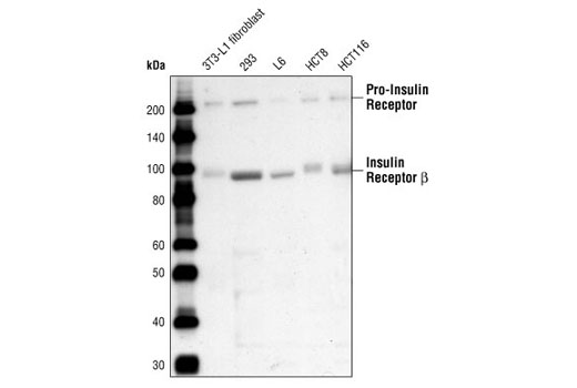 Insulin Receptor β (4B8) Rabbit mAb