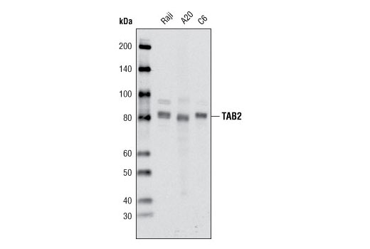 TAB2 (C88H10) Rabbit mAb