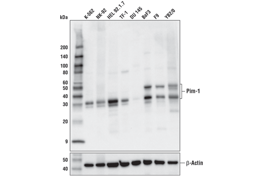 Pim-1 (D8D7Y) Rabbit mAb