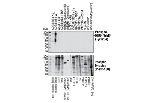 Phospho-HER4/ErbB4 (Tyr1284) (21A9) Rabbit mAb