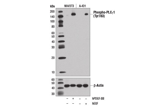 ALK Activation Antibody Sampler Kit