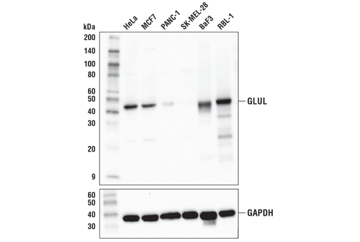 GLUL (D2O3F) Rabbit mAb