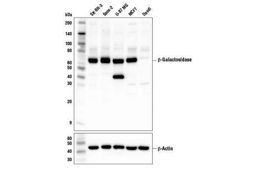 β-Galactosidase (E2U2I) Rabbit mAb