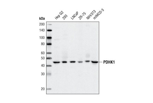 PDHK1 (C47H1) Rabbit mAb