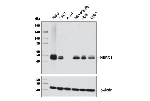 NDRG1 (D8G9) XP Rabbit mAb