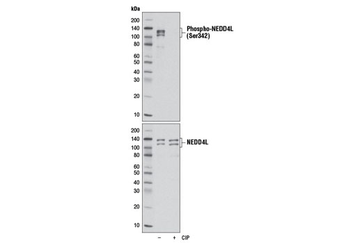 Phospho-NEDD4L (Ser342) (D16D6) Rabbit mAb
