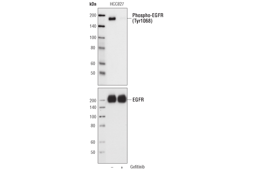 EGF Receptor (EGFR1) Mouse mAb (IP Specific)