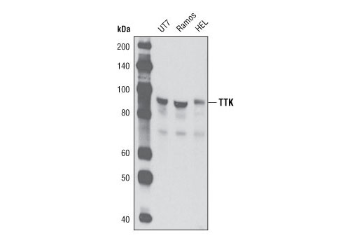 TTK (D15B7) Rabbit mAb