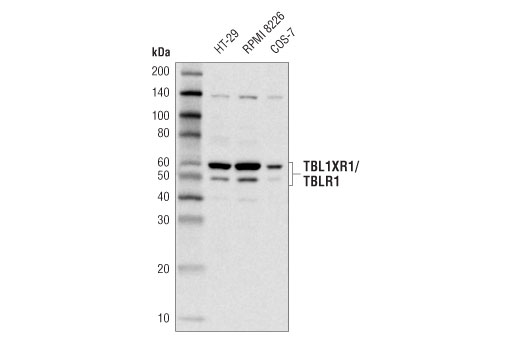 TBL1XR1/TBLR1 (D4J9C) Rabbit mAb