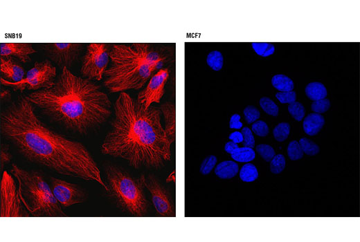 Vimentin (D21H3) XP Rabbit mAb (Alexa Fluor 555 Conjugate)