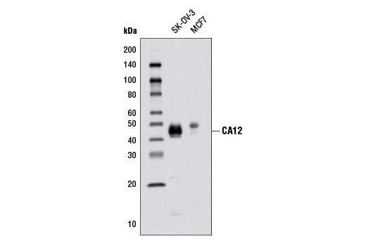 CA12 (D78E4) Rabbit mAb
