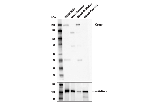 Caspr (D8I3V) Rabbit mAb