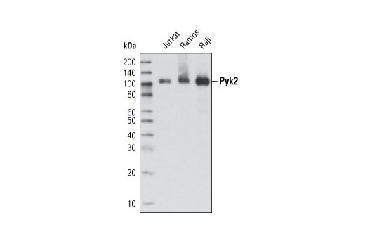 Pyk2 (5E2) Mouse mAb