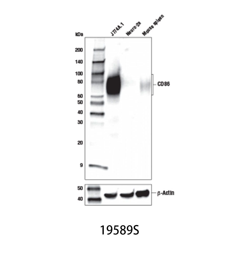 CD86 (E5W6H) Rabbit mAb