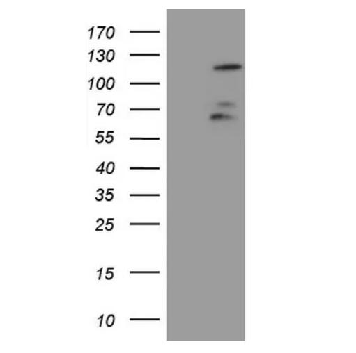 FBXW7 mouse monoclonal Antibody,clone 6F5
