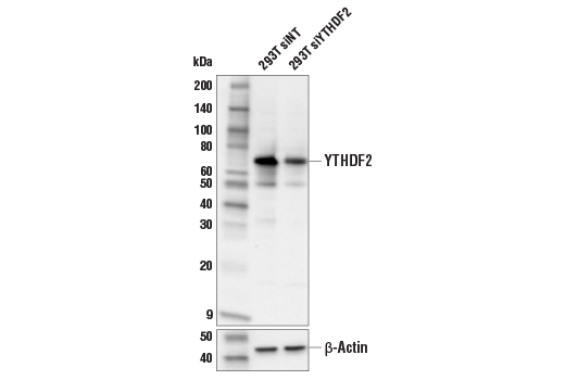 YTHDF2 (E2I2H) Rabbit Monoclonal Antibody