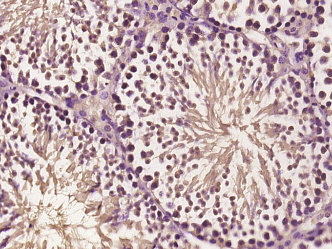 蛋白酶体PSMa6抗体