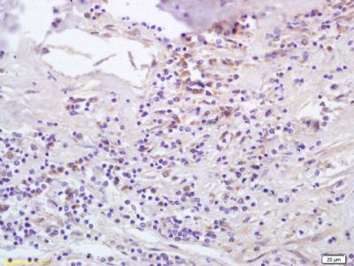 T细胞特异性趋化因子抗体