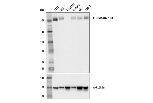 PBRM1/BAF180 (E9X2Z) Rabbit mAb