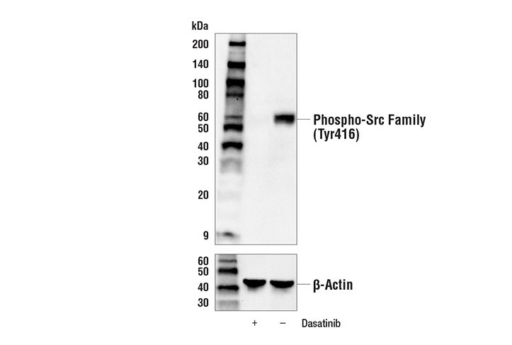 Phospho-Src Family (Tyr416) (E6G4R) Rabbit mAb