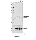 Phospho-Akt Pathway Antibody Sampler Kit