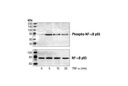 Phospho-NF-κB p65 (Ser536) Antibody