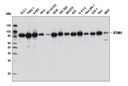 STIM1 (D88E10) Rabbit mAb