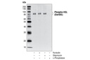 Phospho-HSL (Ser565) Antibody