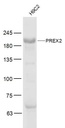 磷脂酰肌醇PREX2抗体