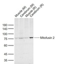 线粒体融合蛋白Mfn2抗体